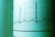 call retry frequency monitoring